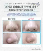 ماسک بینی سه مرحله‌ای الفنت - Image 4