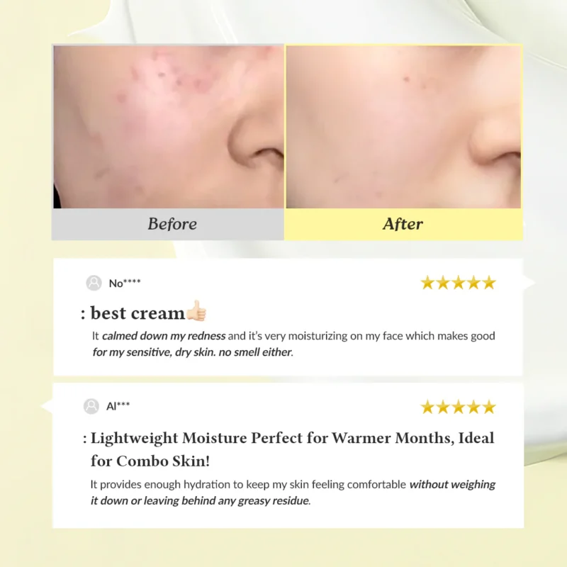 کرم مرطوب‌کننده دکتر آلتیا Relief 345 حجم 50میل - Image 6