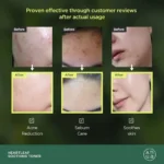 تونر تسکین دهنده آنوا Heartleaf 77 Soothing حجم 250میل - Image 2