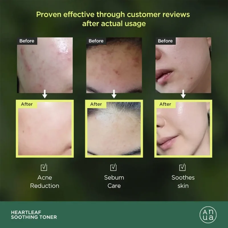 تونر تسکین دهنده آنوا Heartleaf 77 Soothing حجم 250میل - Image 2