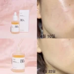 آمپول مرطوبکننده و تسکیندهنده آنوا 80% HeartLeaf - Image 2