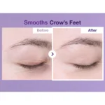 دورچشم ضدچروک و تیرگی نامبوزین شماره 9 Volumetox - Image 5