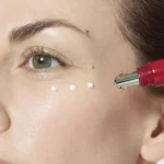 كرم دور چشم ضدچروک لورال REVITALIFT LASER - Image 2