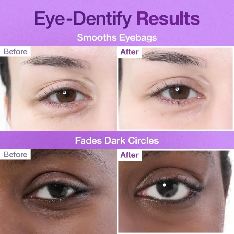 پچ زیر چشم جوانساز نامبوزین شماره 9+ NAD+ Collagen - Image 2