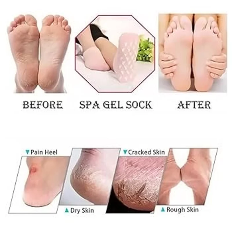 جوراب سیلیکونی مرطوب‌کننده پا مدل Foot Care - Image 5