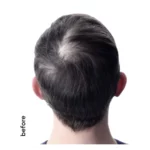 پودر حجم‌دهنده مو تاپیک Hair Building - Image 4