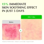 سرم تسکین دهنده اکوال بری Aloe PDRN Calming حجم ۳۰ میل - Image 3