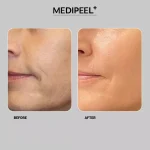 کرم ضدچروک مدی پیل Volume & Tension حجم ۵۰ گرم - Image 5