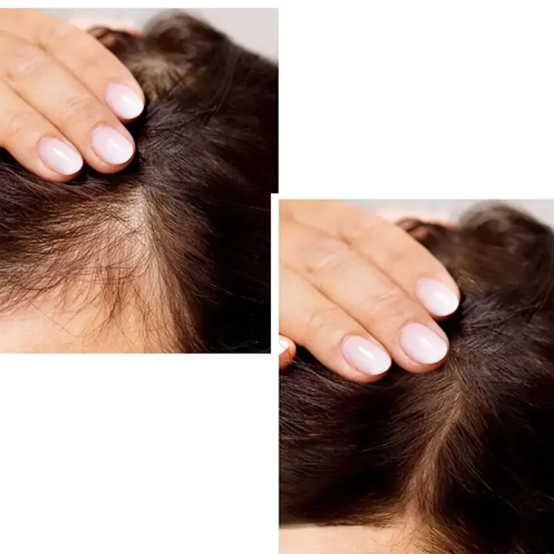 شامپو ضد ریزش رزماری بیوآکوا حجم ۲۵۰ میل - Image 3