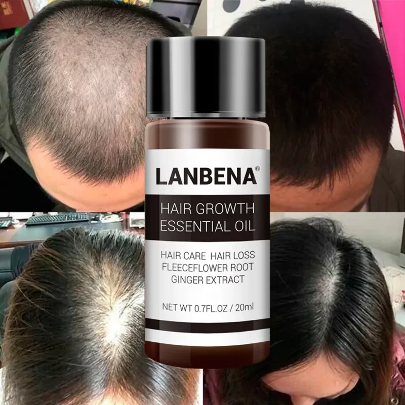 روغن رشد و تقویت مو لانبنا LANBENA حجم 20میل - Image 2