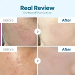 کرم ضدلک دکتر ملاکسین Tranexamic Acid حجم ۵۰ میل - Image 4