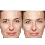 کرم شب لیفت کننده لورآل Age Perfect حجم ۵۰ میل - Image 3