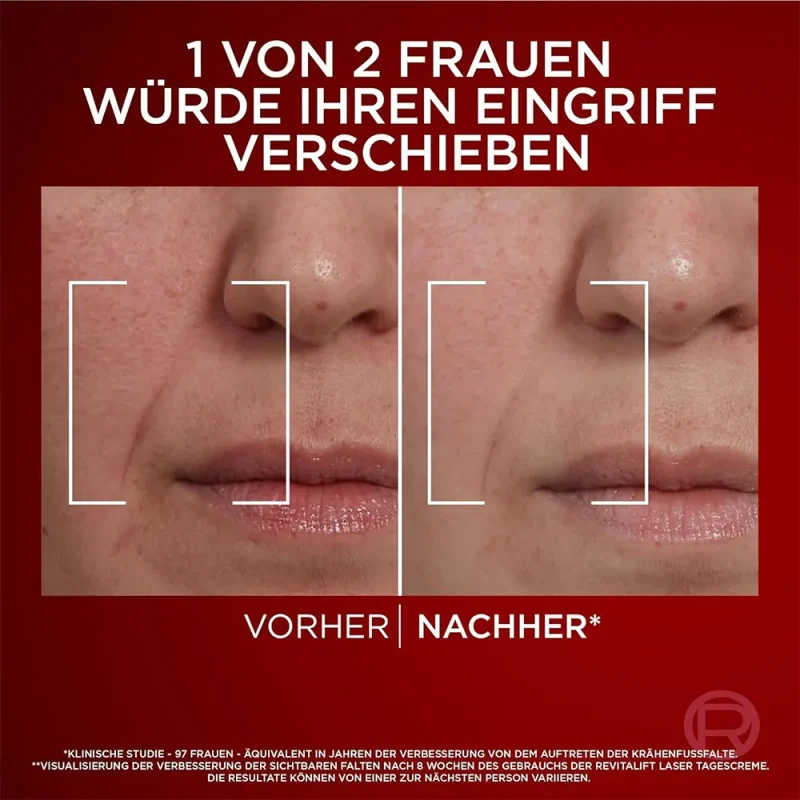 کرم ضد چروک لورآل Revitalift Laser حجم ۵۰ میل - Image 3